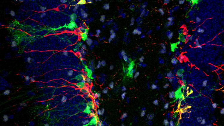 The plastic and robust nervous system is depicted here