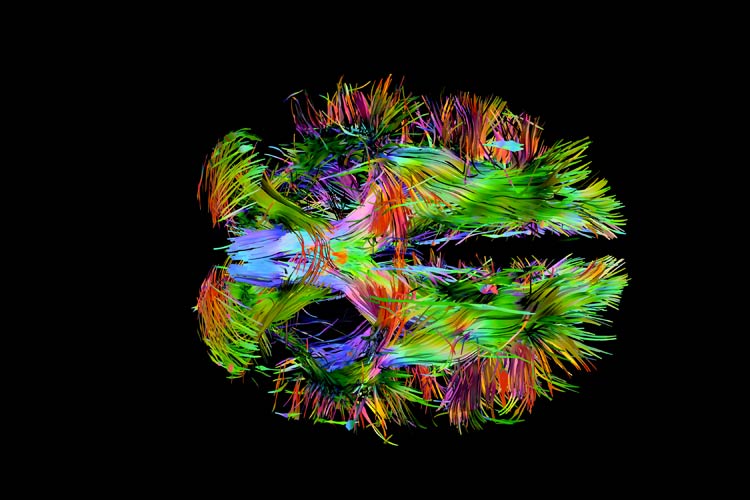 The connectivity of the brain.