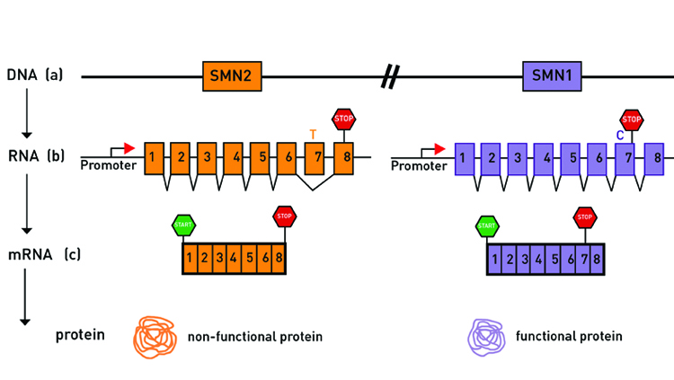 The difference of a single nucleotide — or letter in the genetic code — is what separates the fully functional SMN1 gene from the less functional SMN2 gene. SMA results from mutations in the SMN1 gene. Courtesy of Cure SMA, 2019.