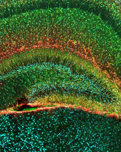 Immunostaining of neural stem cells having a unique morphology called "secondary radial scaffold"(labeled green and red) in the dentate gyrus of a juvenile mouse. Nuclei of neutral stem cells are labeled cyan. (2006) Courtesy, with permission: Noguchi et al., 2016, JNeurosci, 36 (22) 6050-6068.