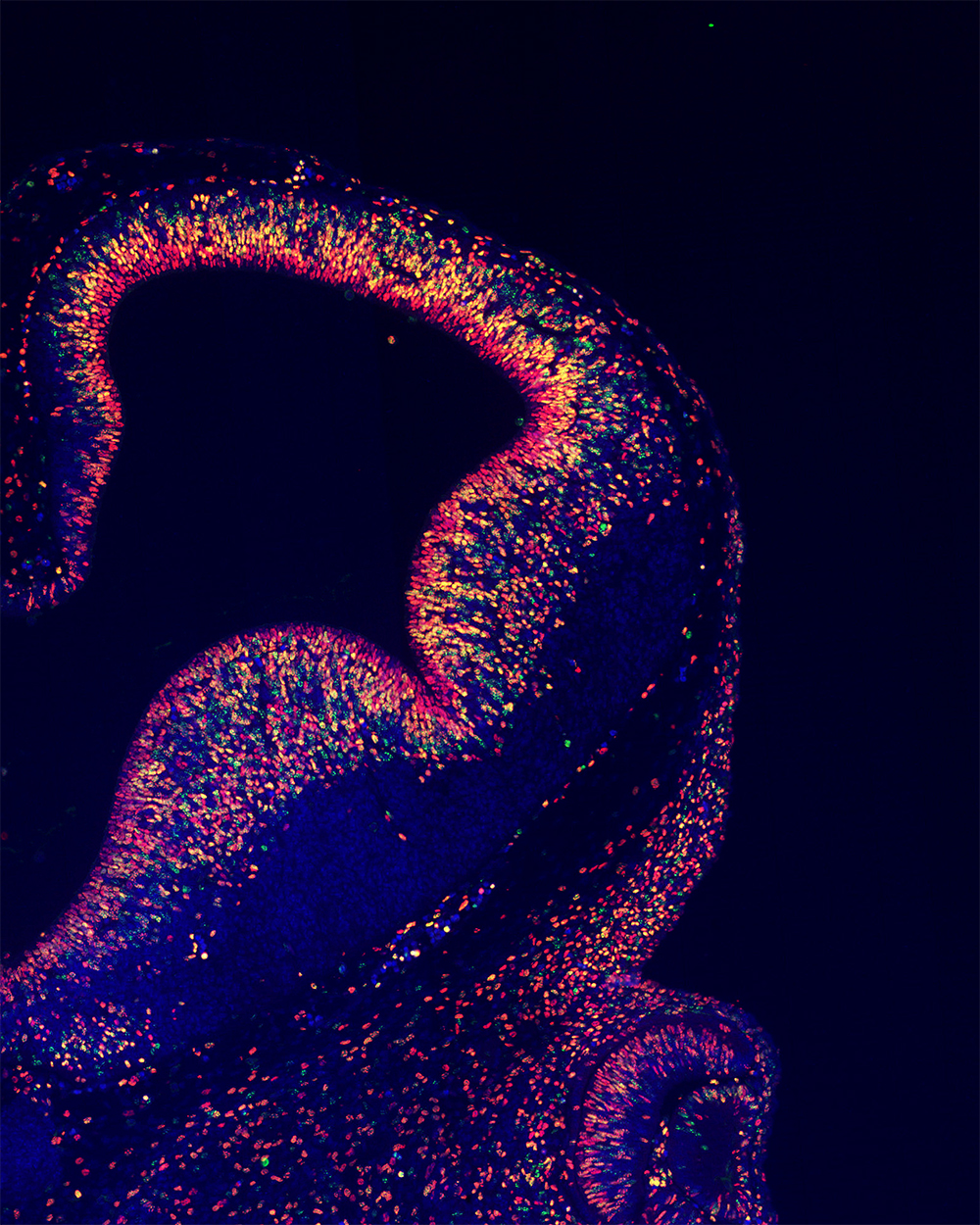 A mouse embryo forebrain on day 11 of development. Nuclei labeled green are daughter cells produced by cell division of neural progenitor cells. Other nuclei are labeled red; double-labeled nuclei are yellow, Courtesy, with permission: Fujimura et al., 2016, JNeurosci, 36 (42) 10908-10919.