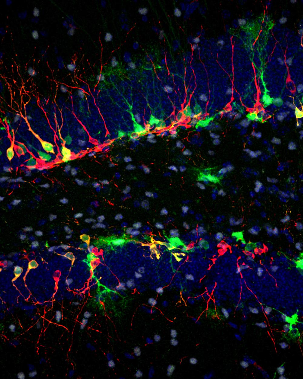An adult mouse hippocampus with neurogenesis markers. Radial glia-like neural stem cells and their progenies are labeled green. Adult-born neurons and neural stem cells/neural progenitors are stained red and white, respectively. Nuclei are labeled blue. Courtesy, with permission: Kuhn et al., 2018, JNeurosci, 38 (49) 10401-10410.
