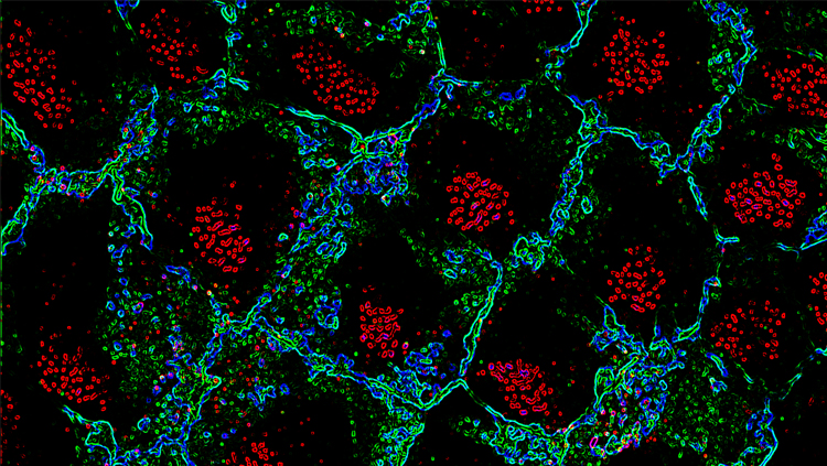 Ependymal cell basal bodies (red) are clustered in a patch just below the surface of ependymal cells outlined in green. Courtesy, with permission: Mirzadeh et al., 2010, JNeurosci, 30 (7) 2600-2610.