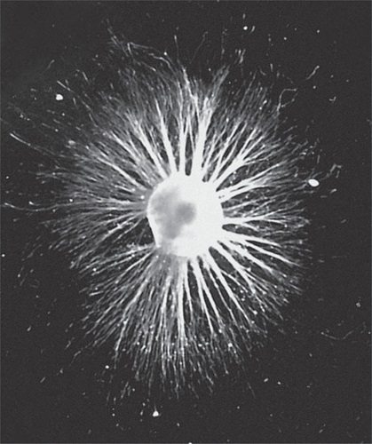 A dorsal root ganglion neuron 24 hours after exposure to nerve growth factor. (2003) Courtesy, with permission: Mills et al., 2003, JNeurosci, 23 (5) 1638-1648.