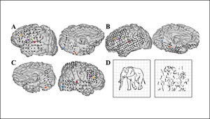 Dynamic Brain Interactions During Picture Naming