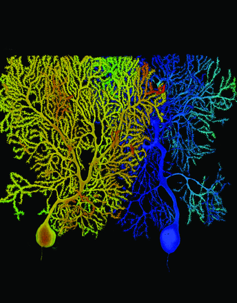 This image shows the dendritic trees of two Purkinje cells from wild-type (left, orange) and mutant mice lacking the alpha- and gamma-Protocadherin gene clusters