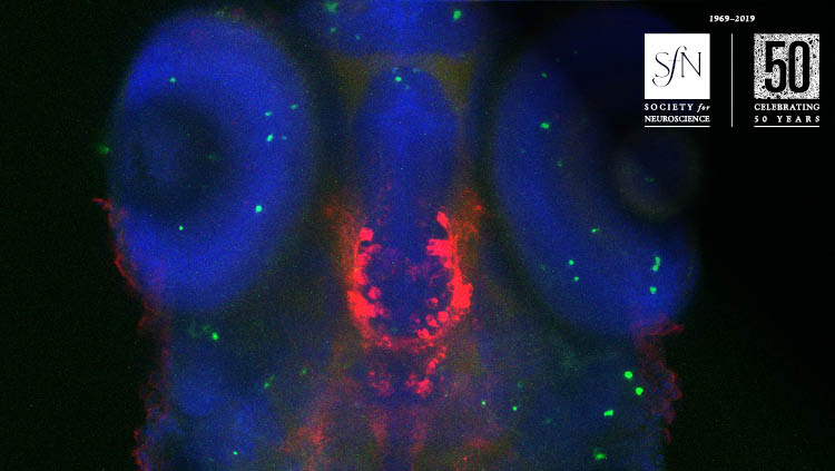 Image from Dopaminergic Co-Regulation of Locomotor Development and Motor Neuron Synaptogenesis is Uncoupled by Hypoxia in Zebrafish