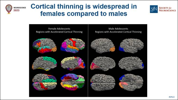 Inside Neuroscience thumbnail image