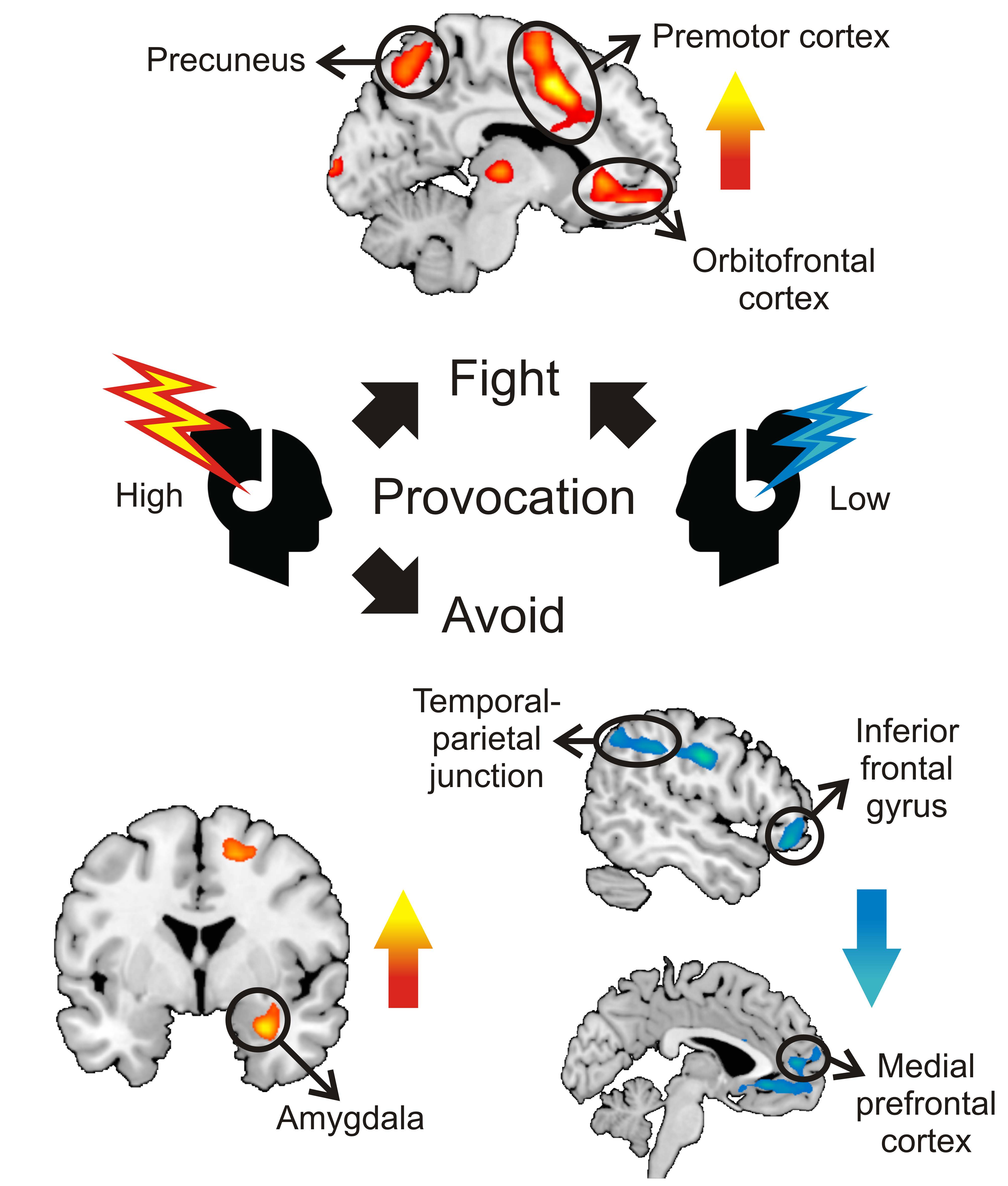 Fight and Flight Responses to Social Threat Visual Abstract 